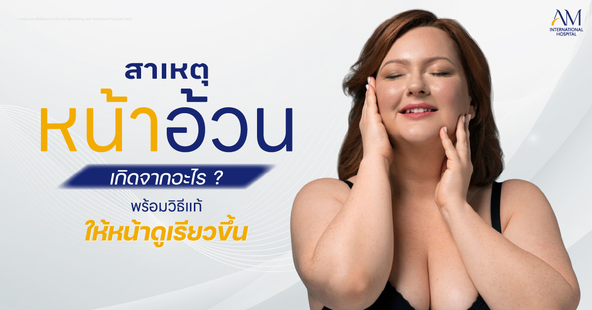 หน้าอ้วน