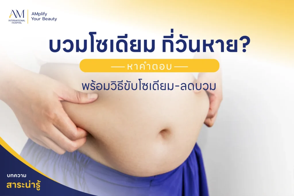 บวมโซเดียม กี่วันหาย