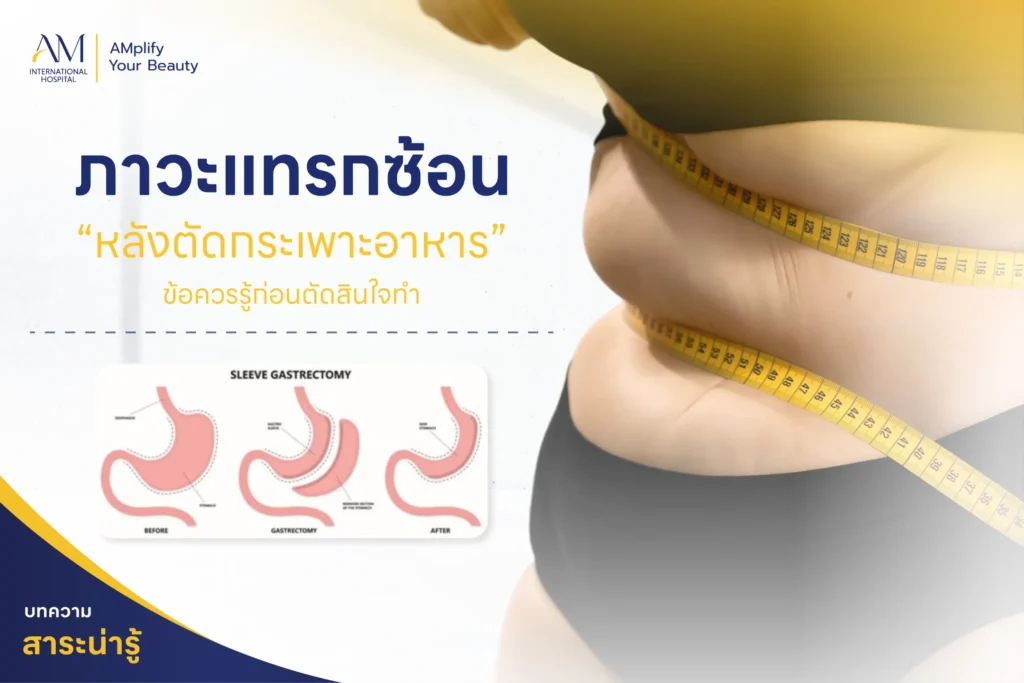 ภาวะแทรกซ้อน หลังตัดกระเพาะอาหาร