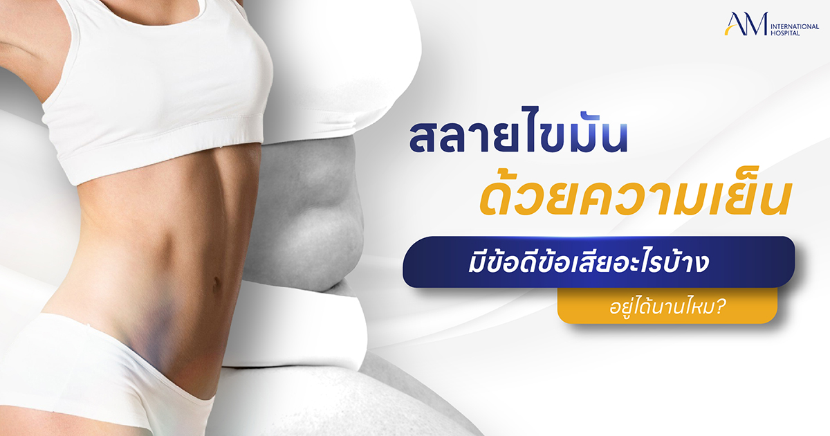 สลายไขมันด้วยความเย็น