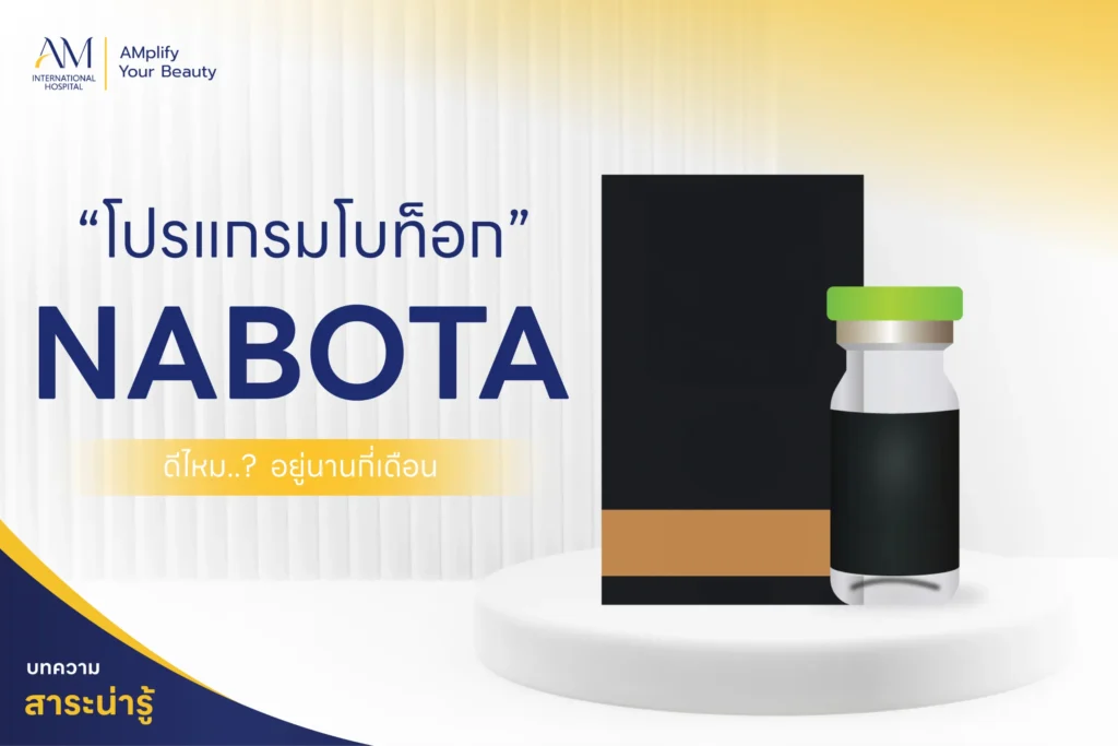 โบท็อก Nabota