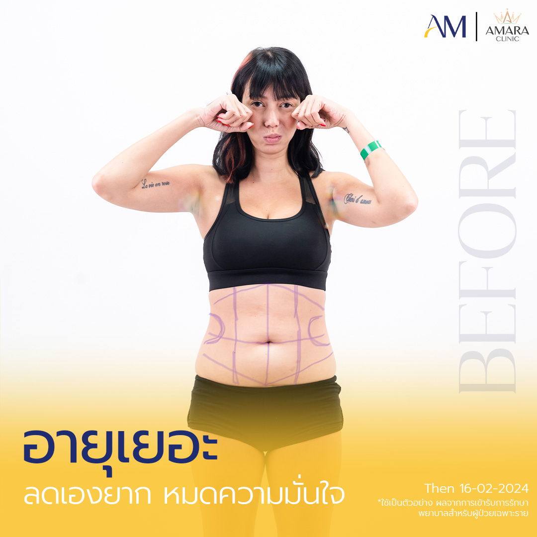 20250219-Aware-Album-2025-02-07-UGC คุณโอเด็ต 11765-2