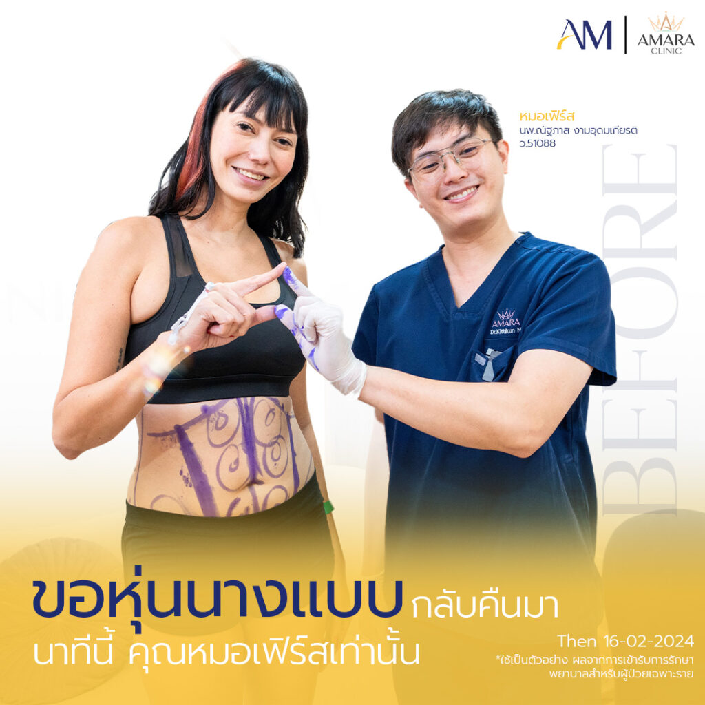 ก่อนทำและหลังทำ โปรแกรม Ultherapy