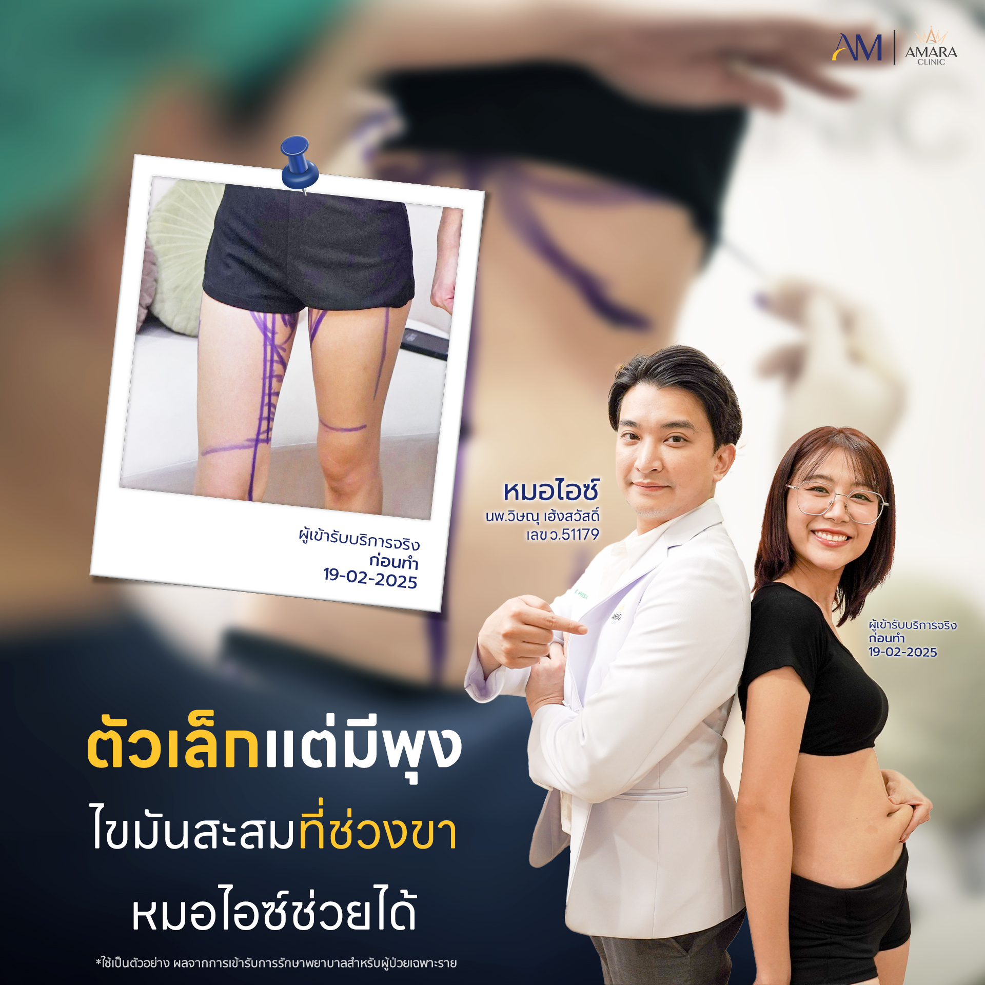 20250404-Aware-Album-ร้อนระอุ-13039-คุณเฮ็นนะ-2