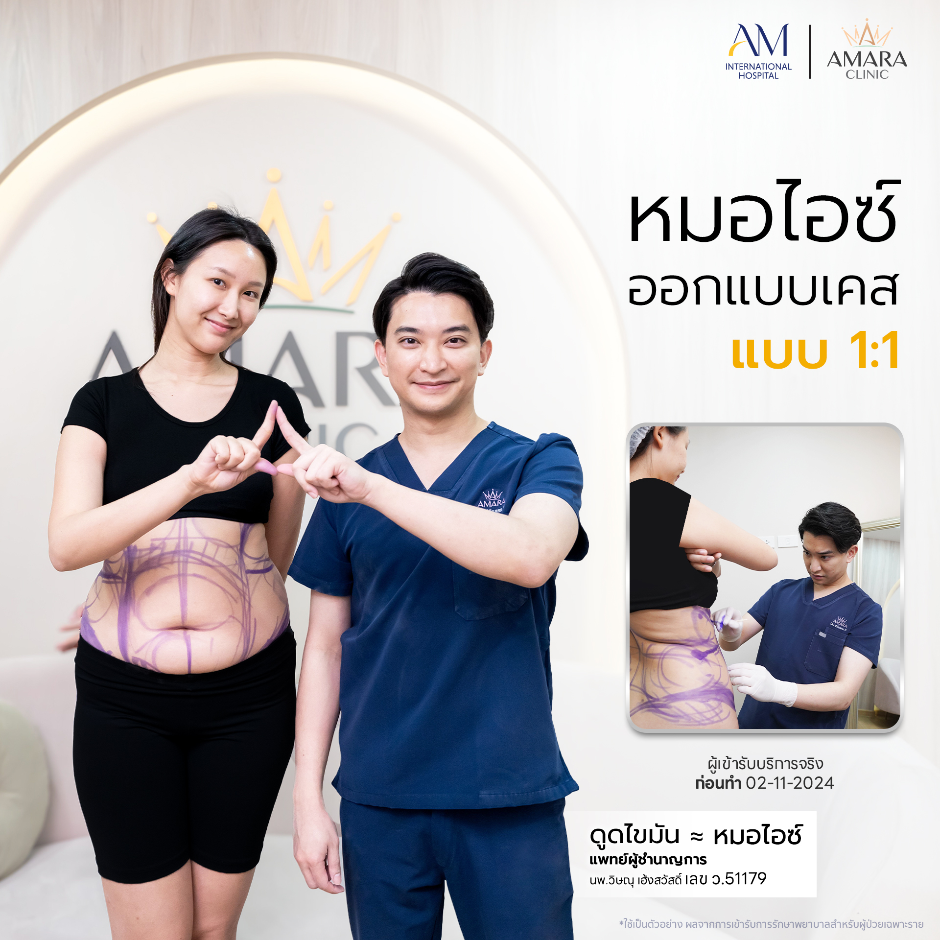 20250624-Aware-Album-ไม่บีบรูป-7081-คุณมุก-2