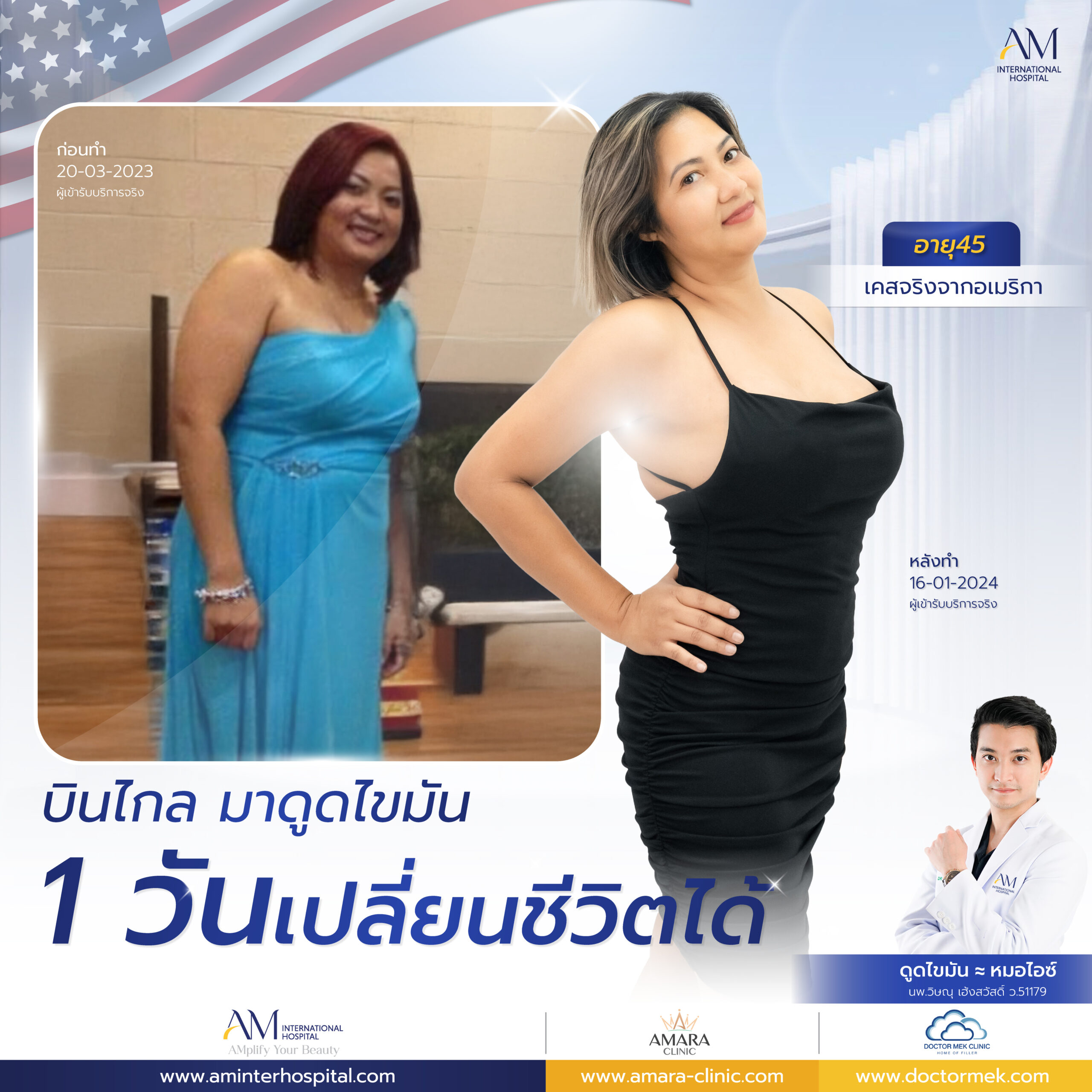 20250709-awareness-single-Lipo Plus-9039