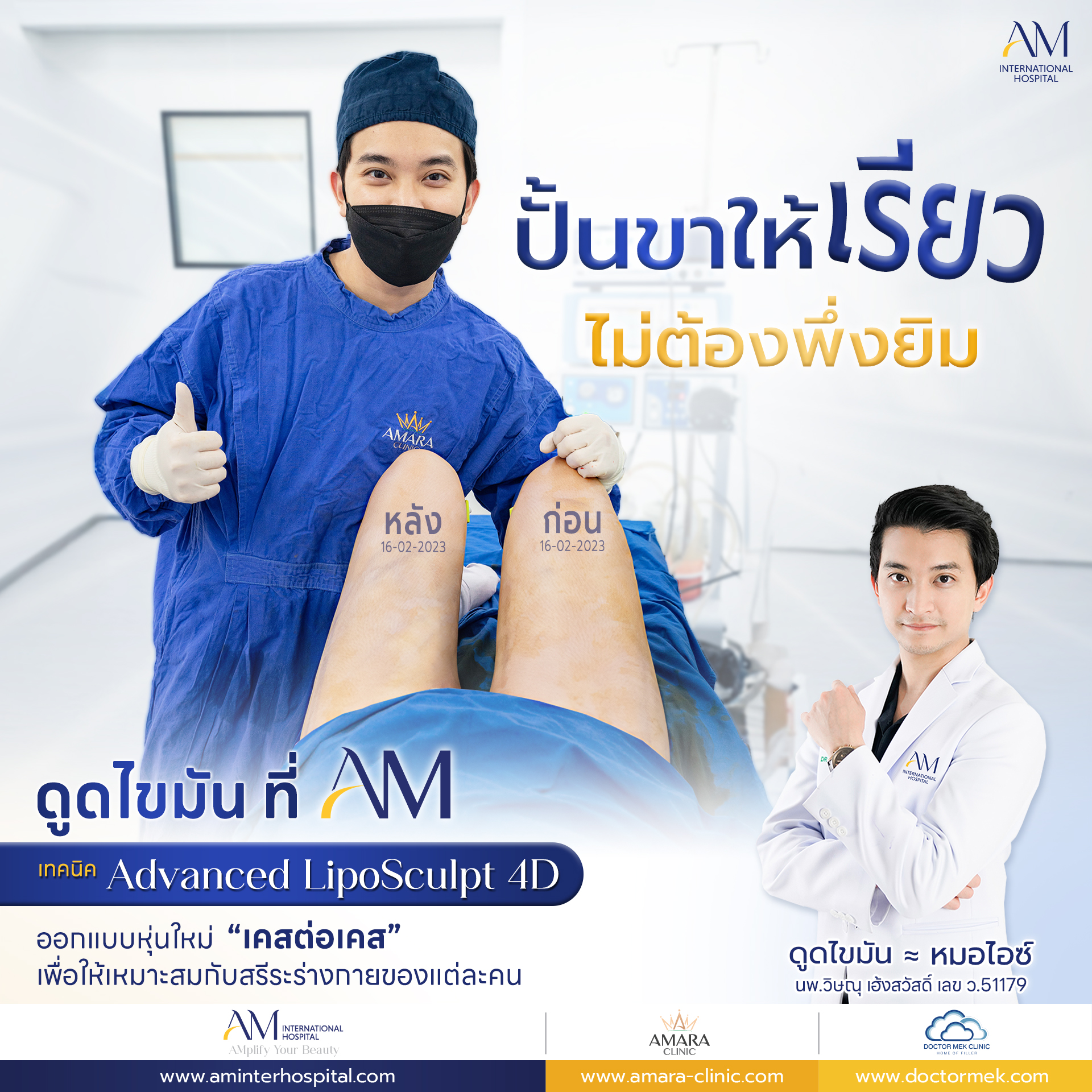 20250714-Aware-Single-ดูดไขมันขา-9161