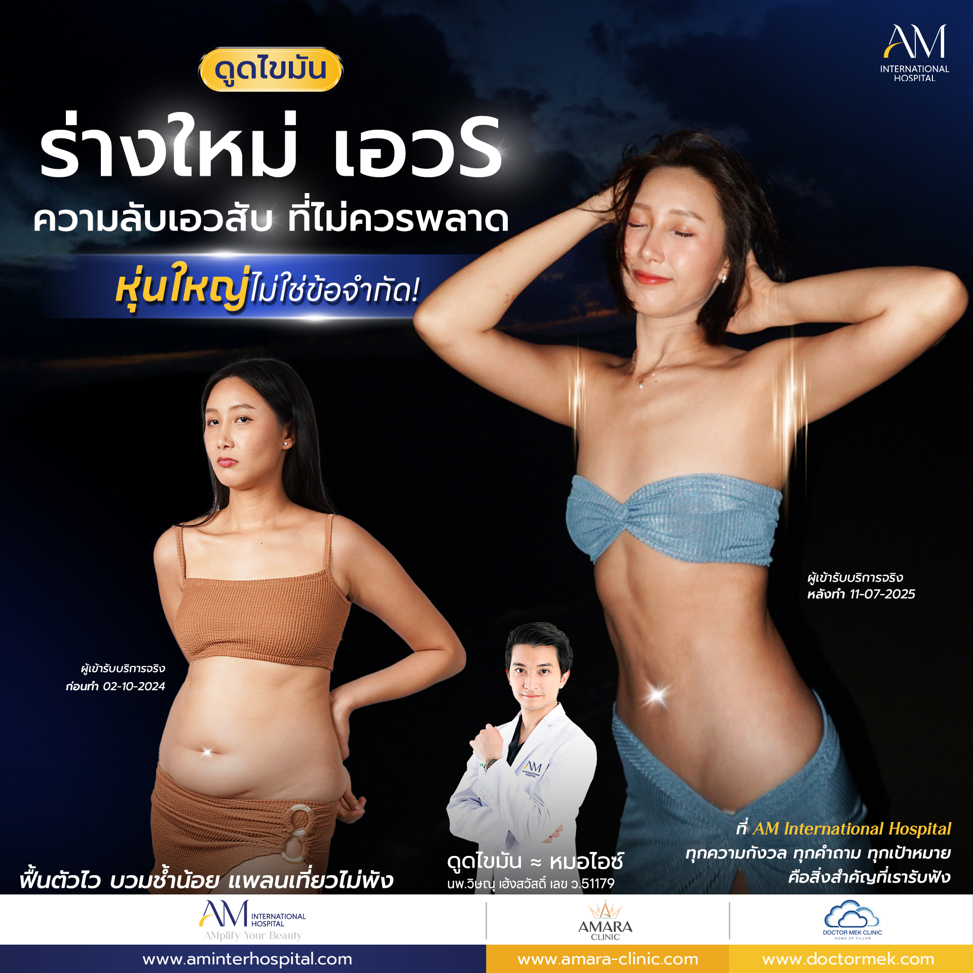 20250714-Aware-Single-ดูดไขมันร่อง 11-7081