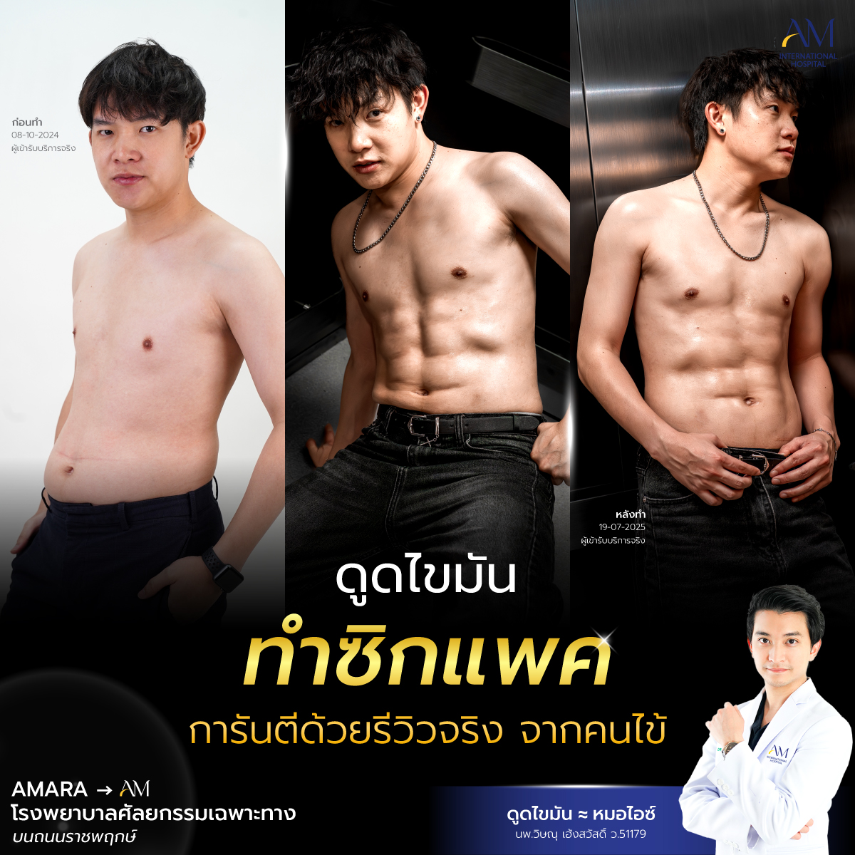 20250721-awareness-single-ดูดไขมัน 13760