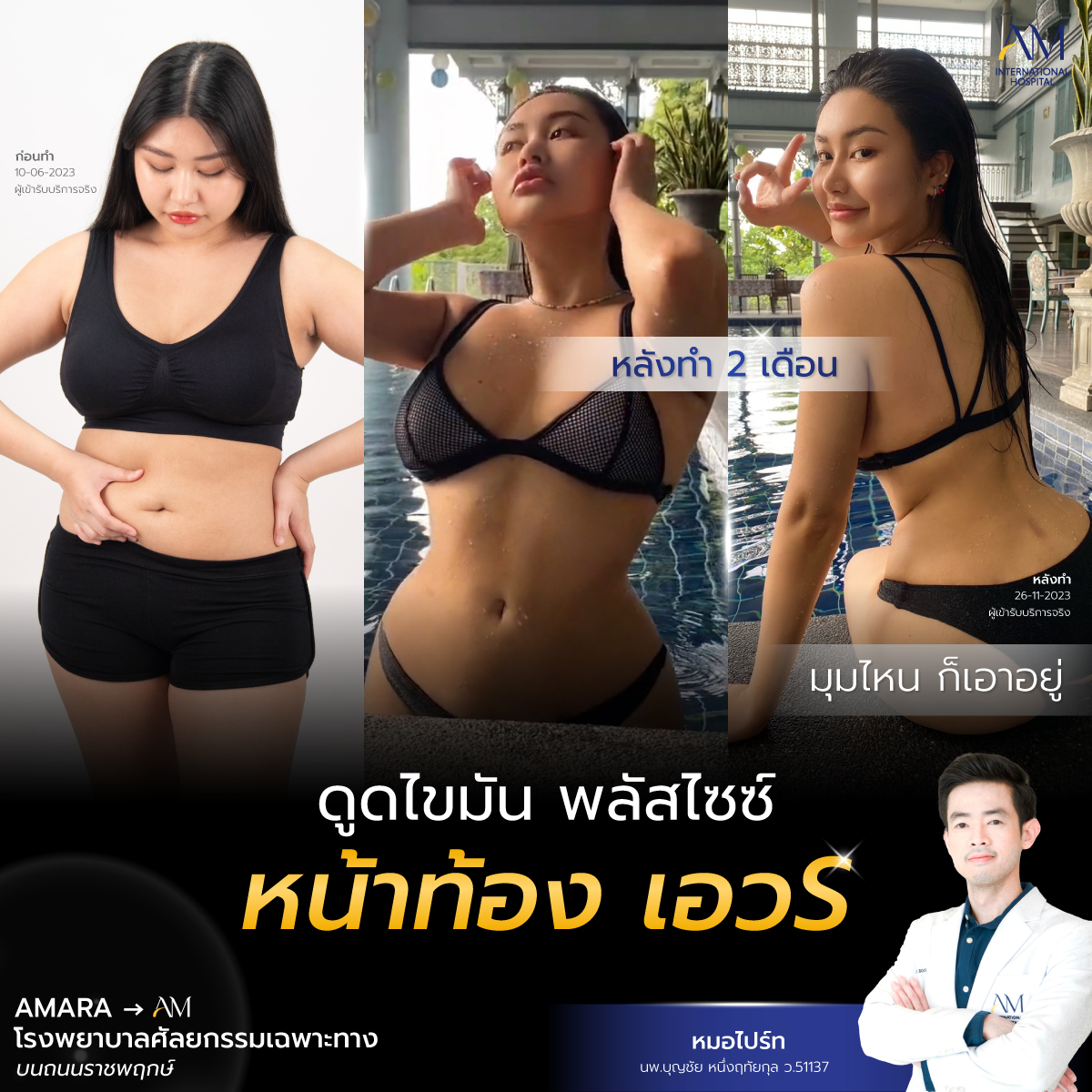 20250721-awareness-single-ท้อง แขน ออม 6900