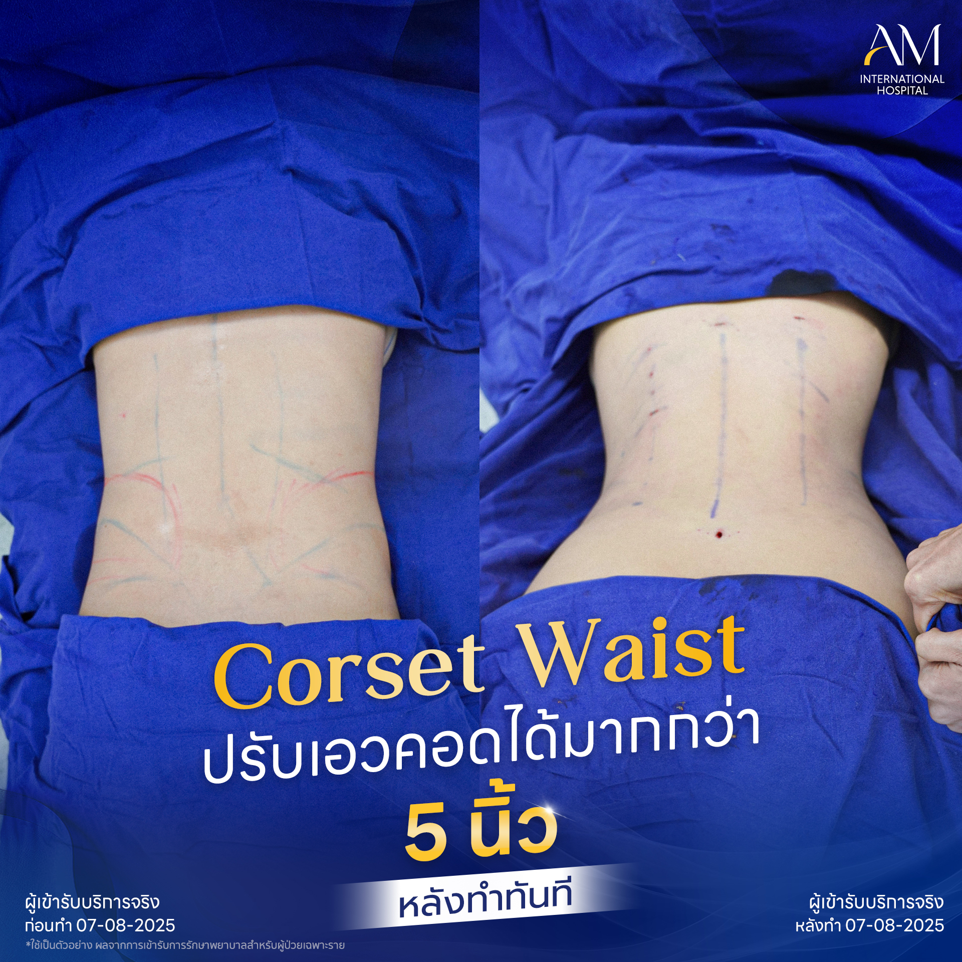 20250811-BA-Line-Corset waist 2025_5