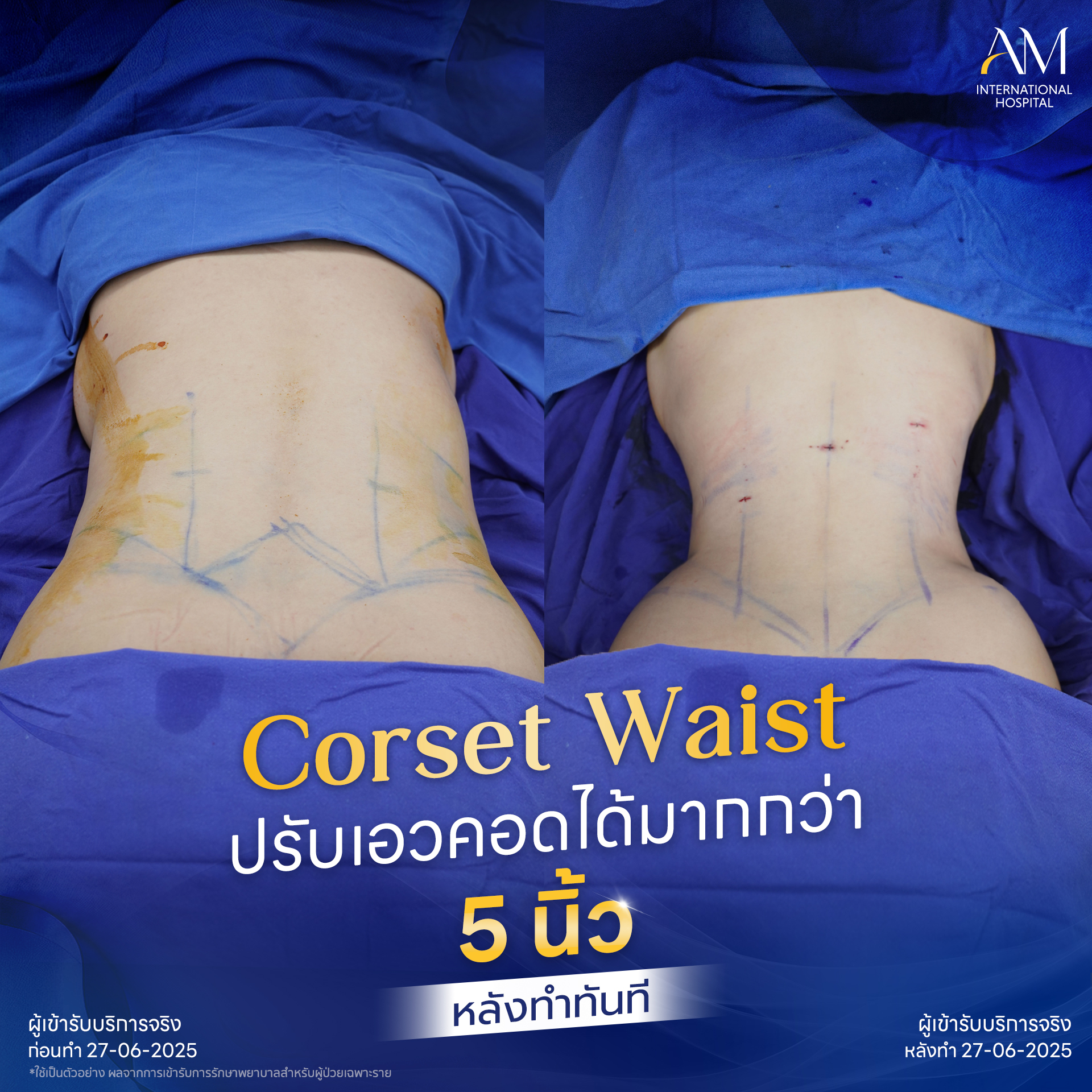 20250811-BA-Line-Corset waist 2025_6