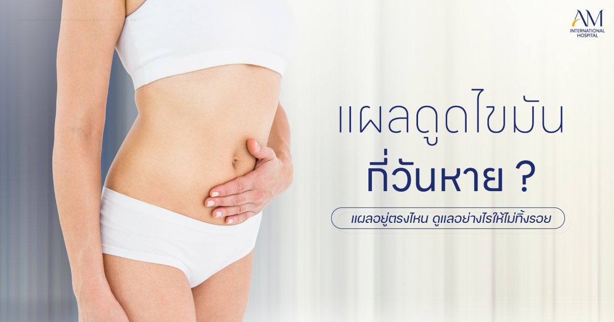 แผลดูดไขมัน
