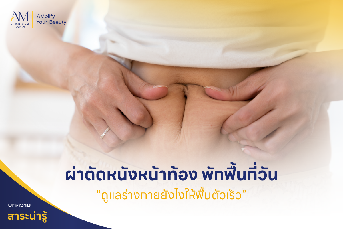 ผ่าตัดหนังหน้าท้อง พักฟื้นกี่วัน