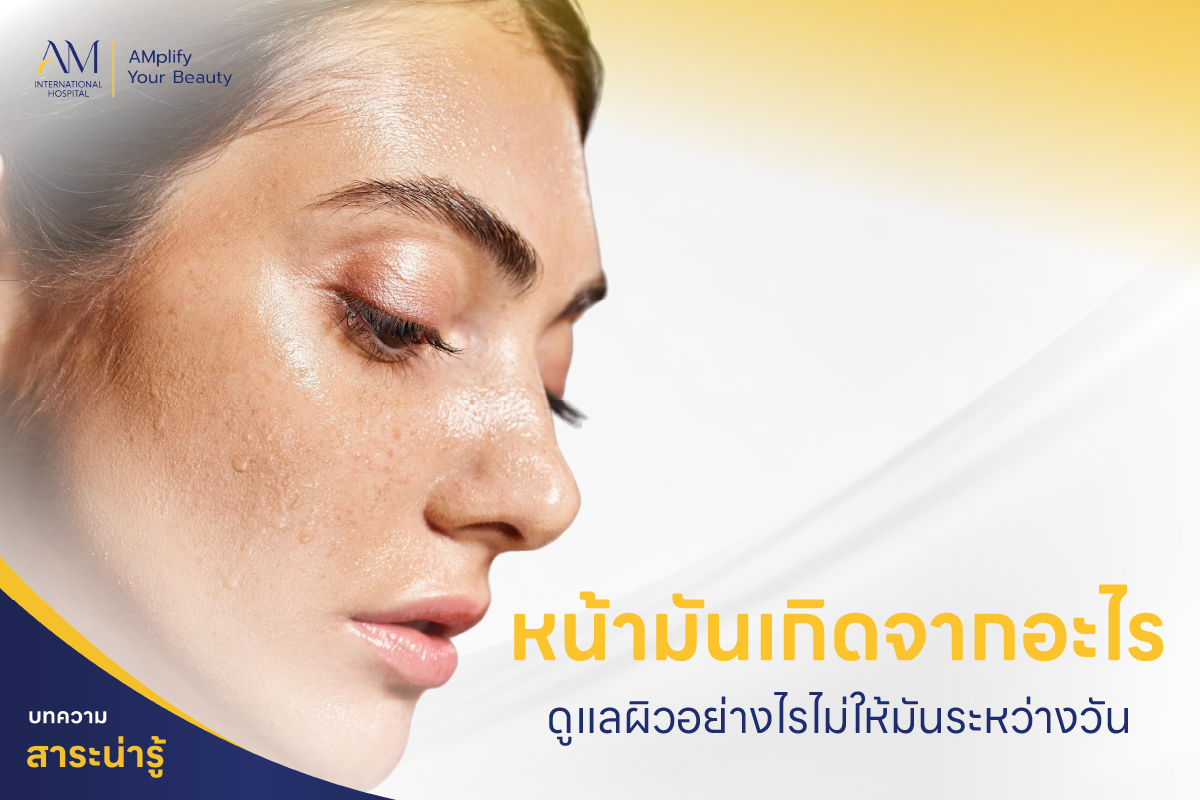 หน้ามันเกิดจากอะไร