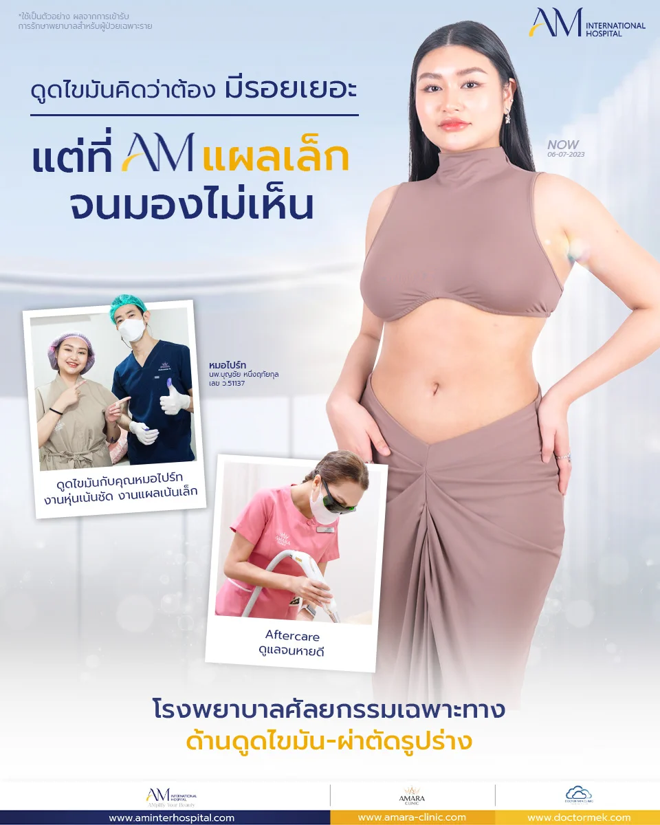 แผลดูดไขมัน