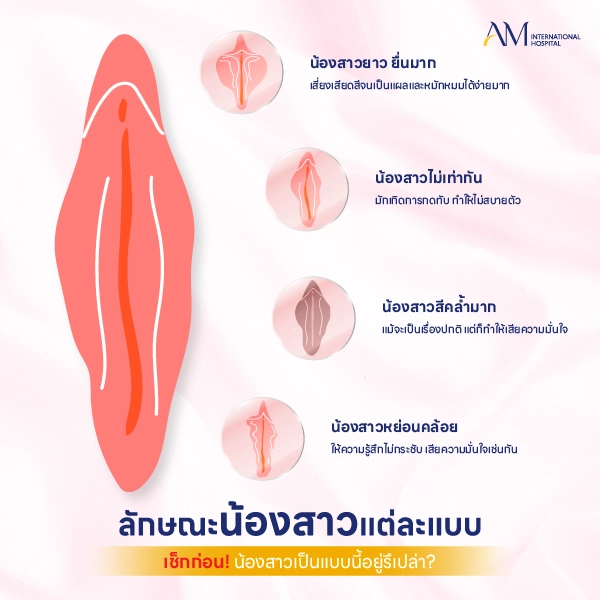 เลเบียมีกี่แบบ