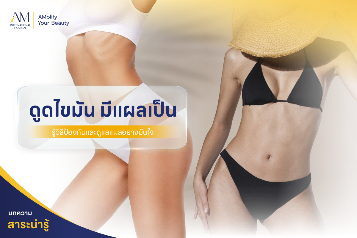 ดูดไขมัน แผลเป็น