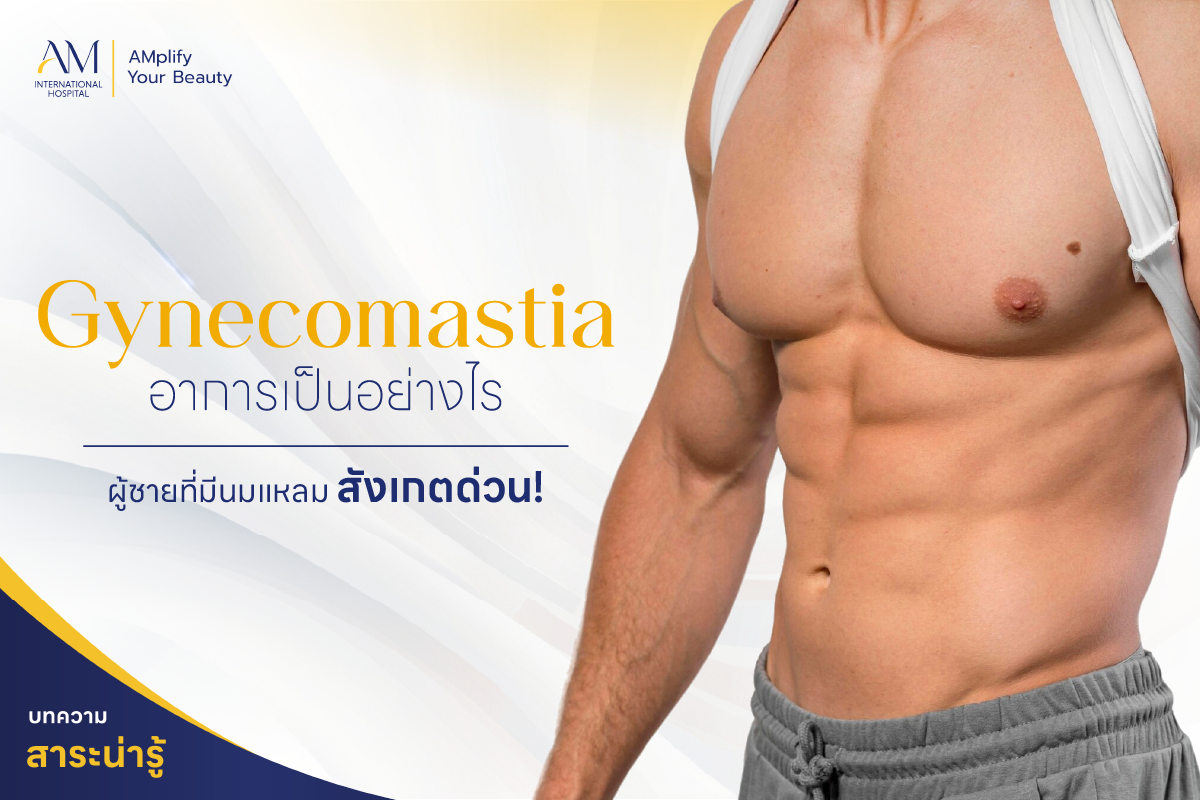 gynecomastia อาการ