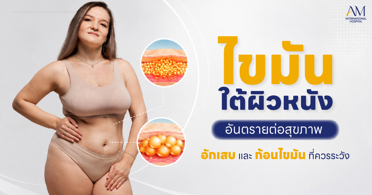 ไขมันใต้ผิวหนัง