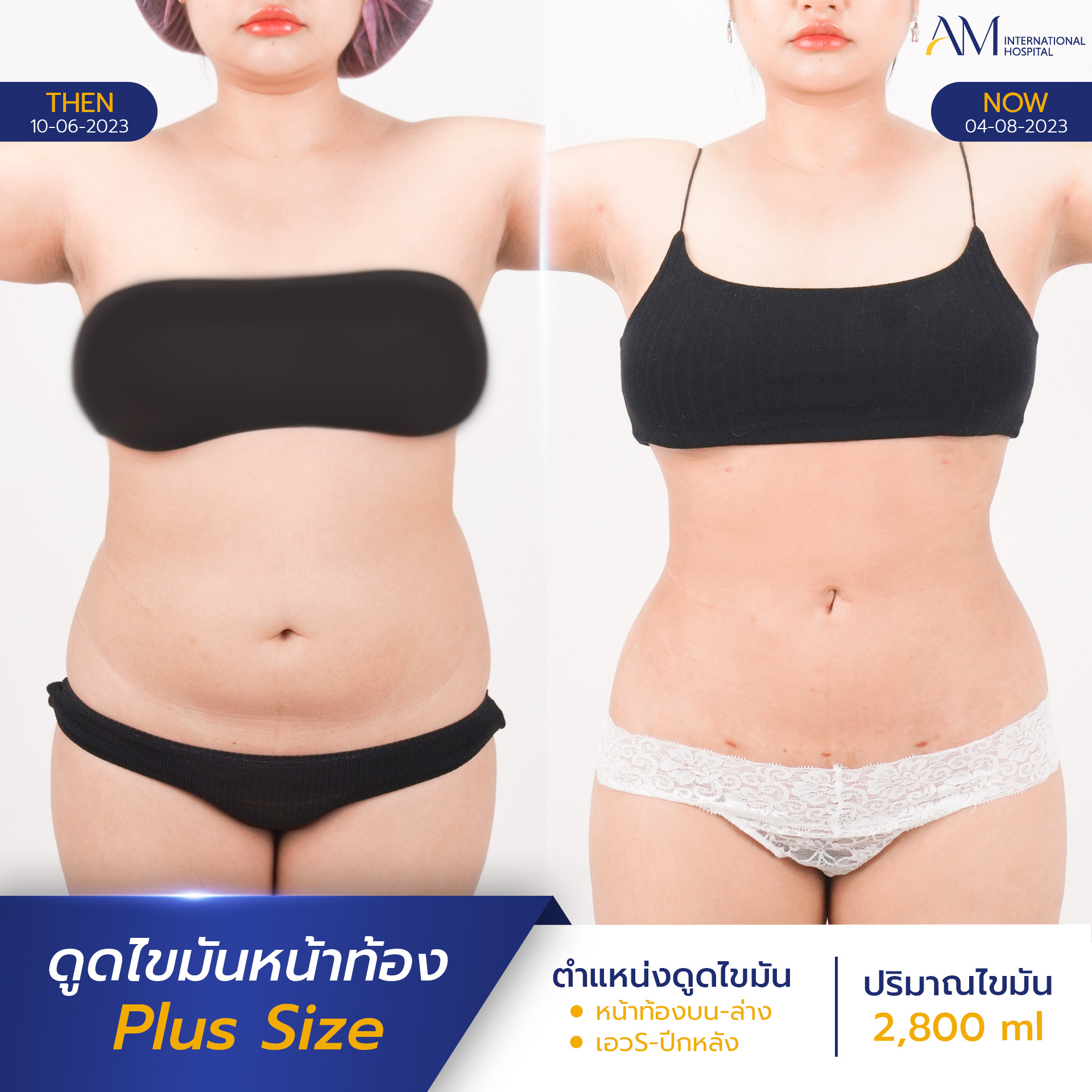 20250817-2025-08-15-AMINTER-BA-LIPO-Plus-ท้อง-9600