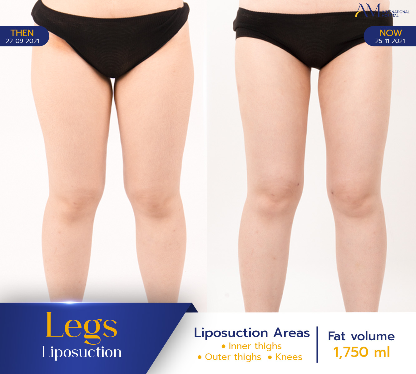 20260123-2026-01-23-LINECARD-MAR9-AMARA-3