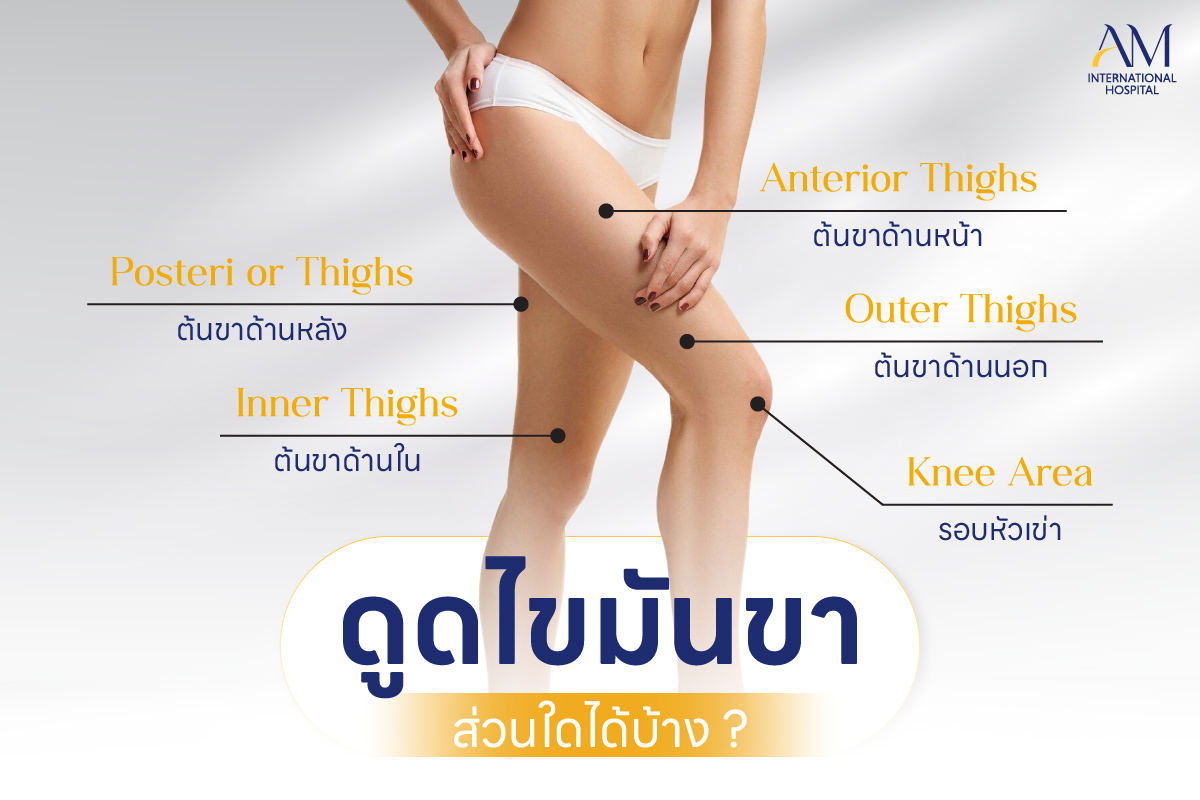 ดูดไขมันขา ส่วนใดได้บ้าง