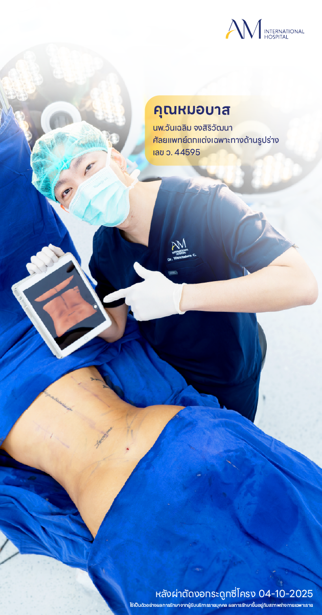 หลังผ่าตัดงอกระดูกซี่โครง คุณโบโย่