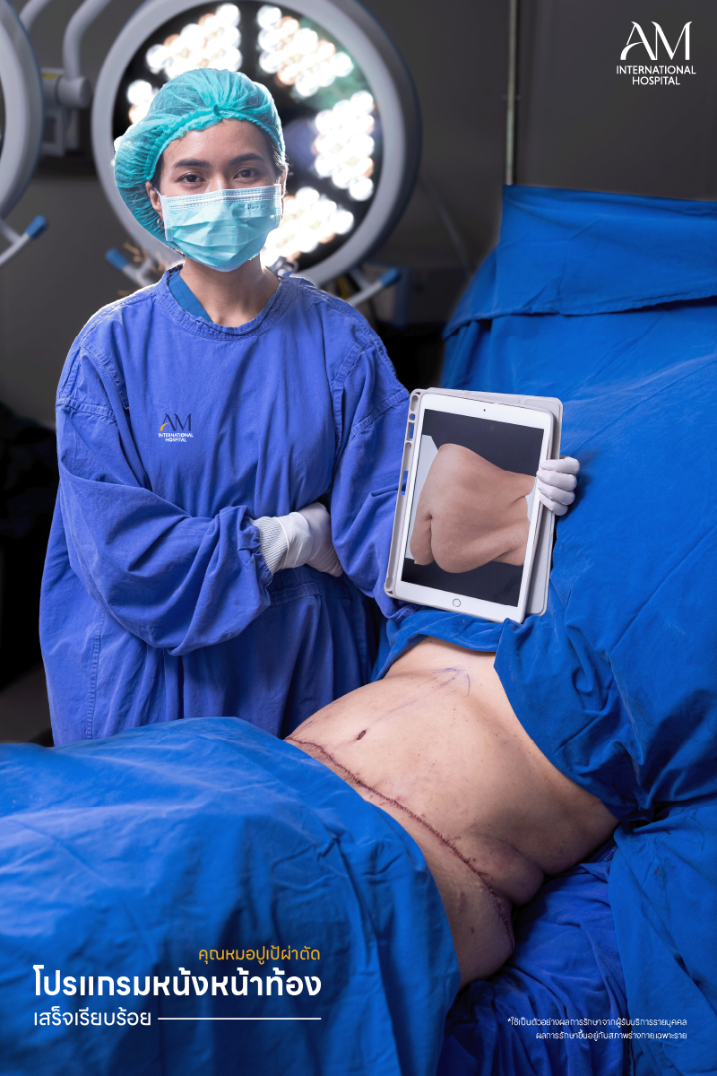 รีวิวผ่าตัดหนังหน้าท้อง ที่ AM International Hospital