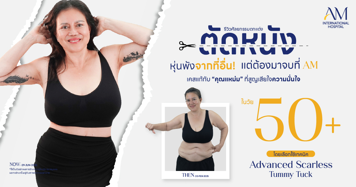 รีวิวตัดหนังหน้าท้อง