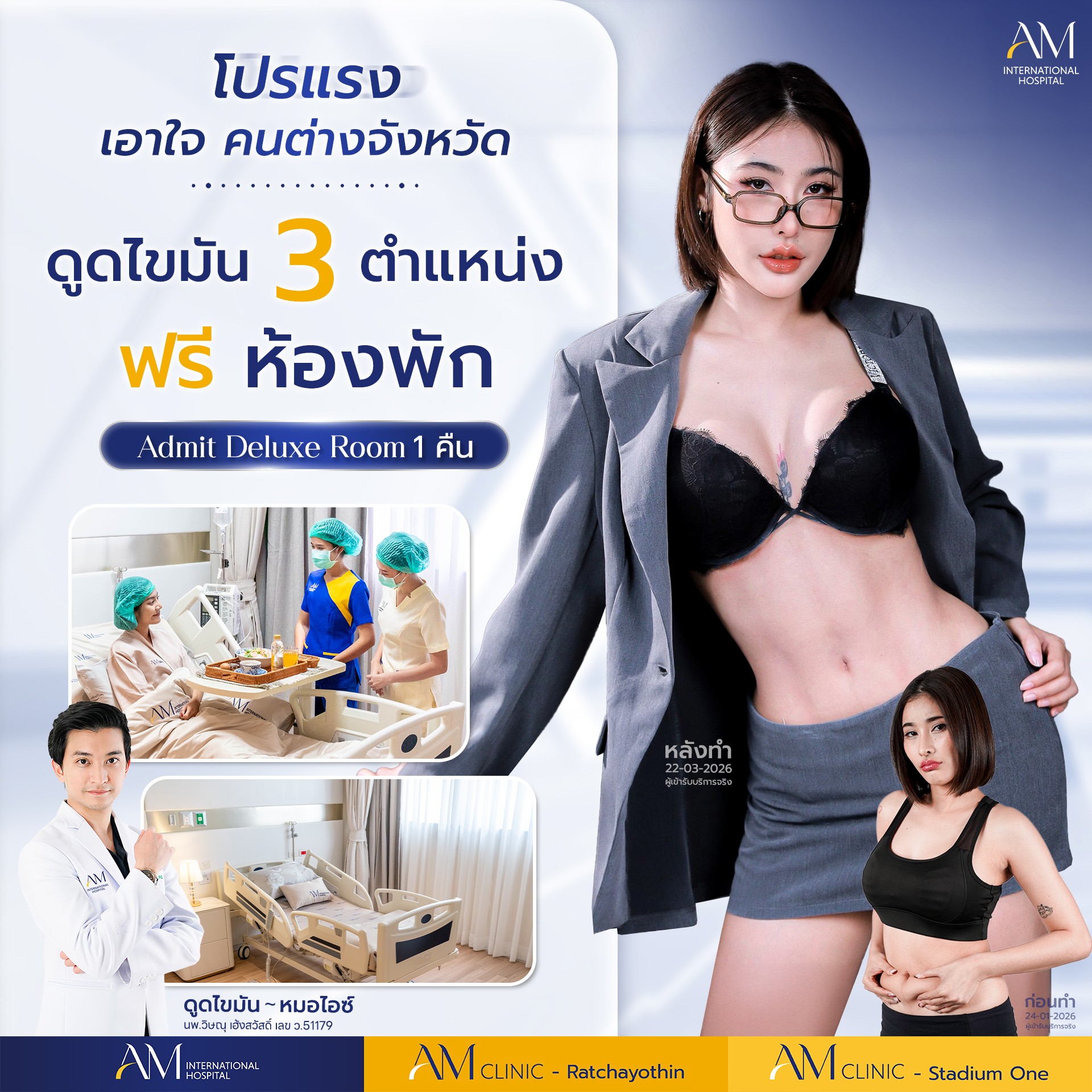 20260325-Conver-Single-โปรดูด 3 จุด ฟรีห้องพัก