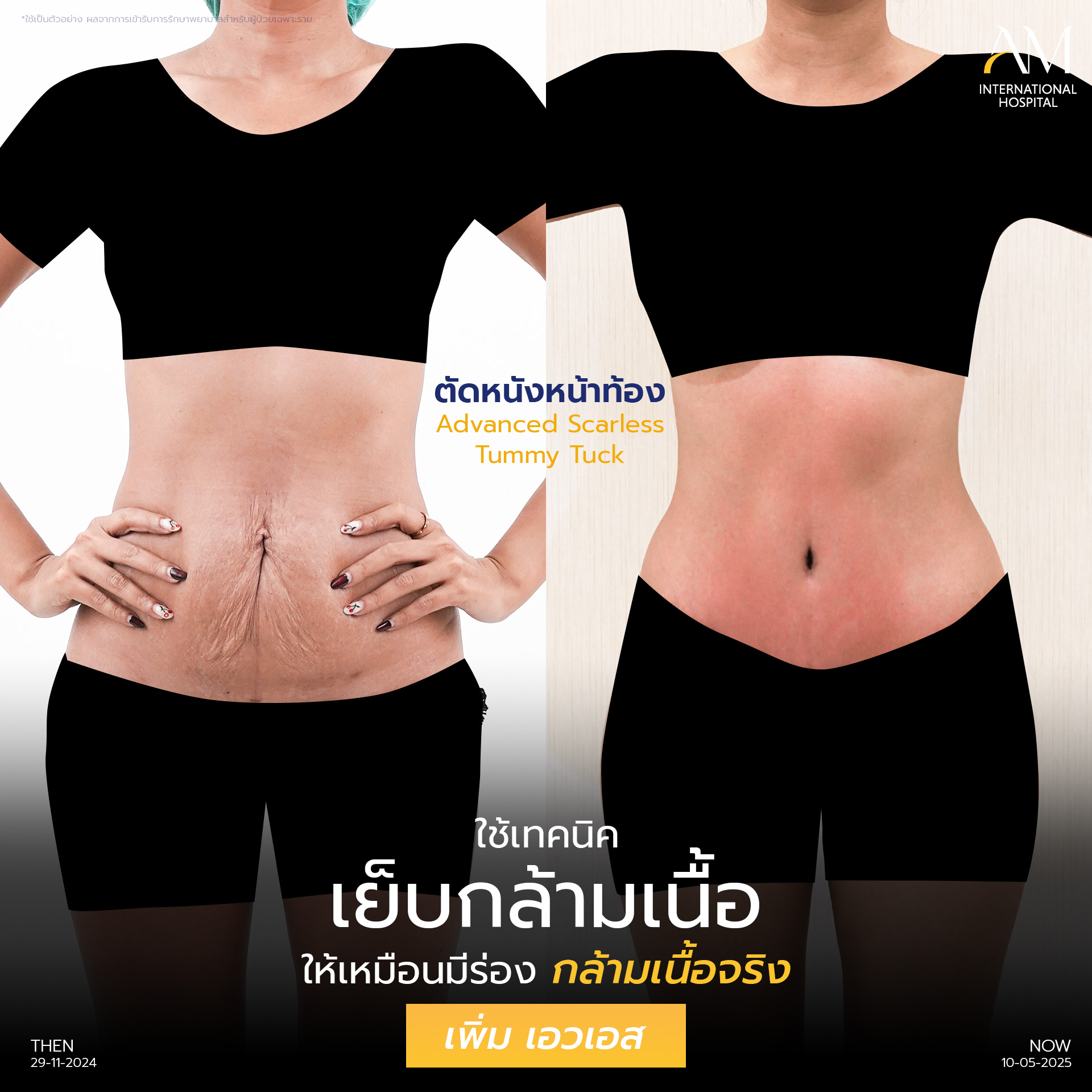 20251222-Aware-Album-2025-01-04 โชว์หน้าท้อง รับปี 69-2