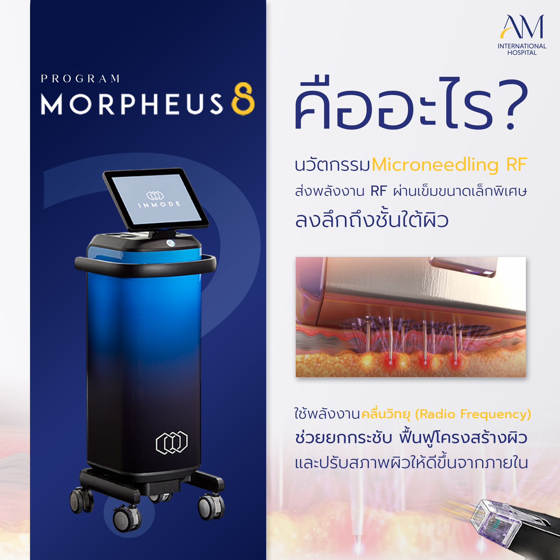 Morpheus8 คืออะไร