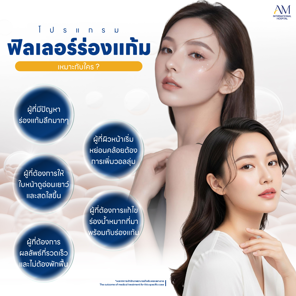ฟิลเลอร์ร่องแก้ม เหมาะกับใคร