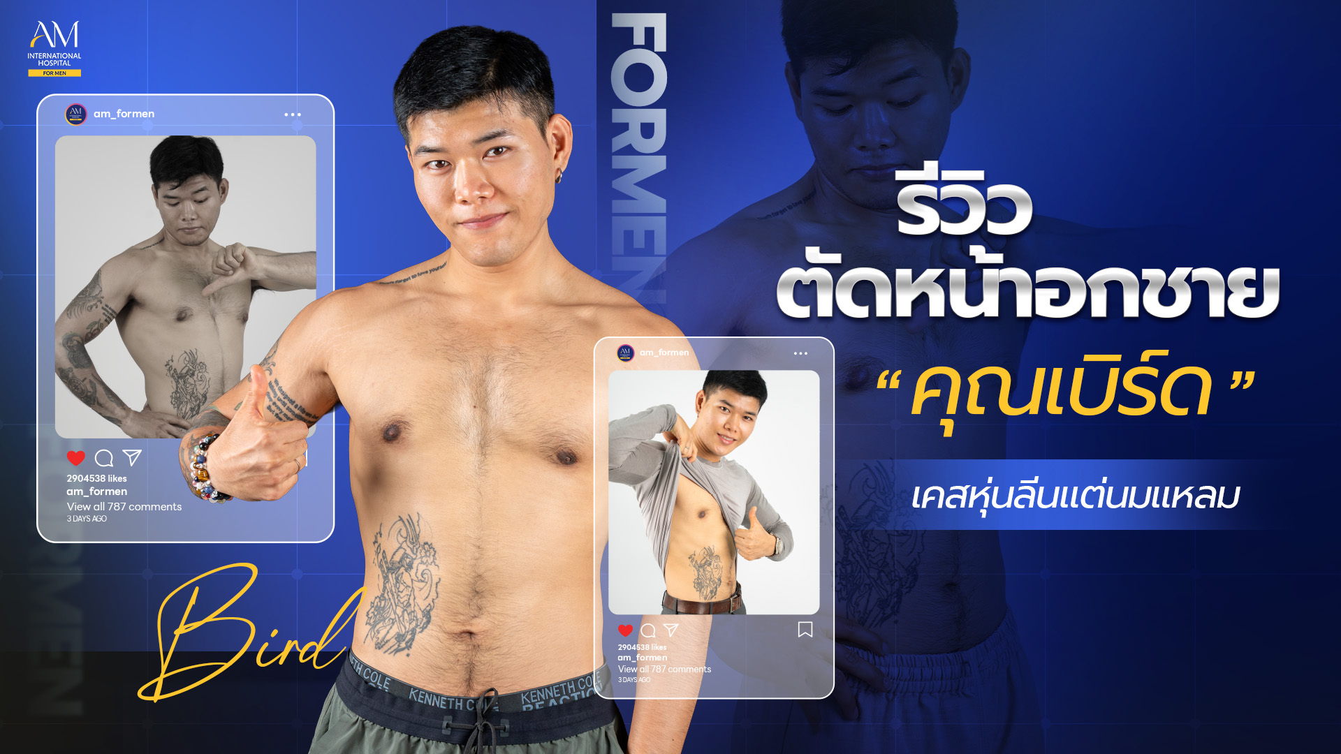 รีวิวตัดหน้าอกชาย