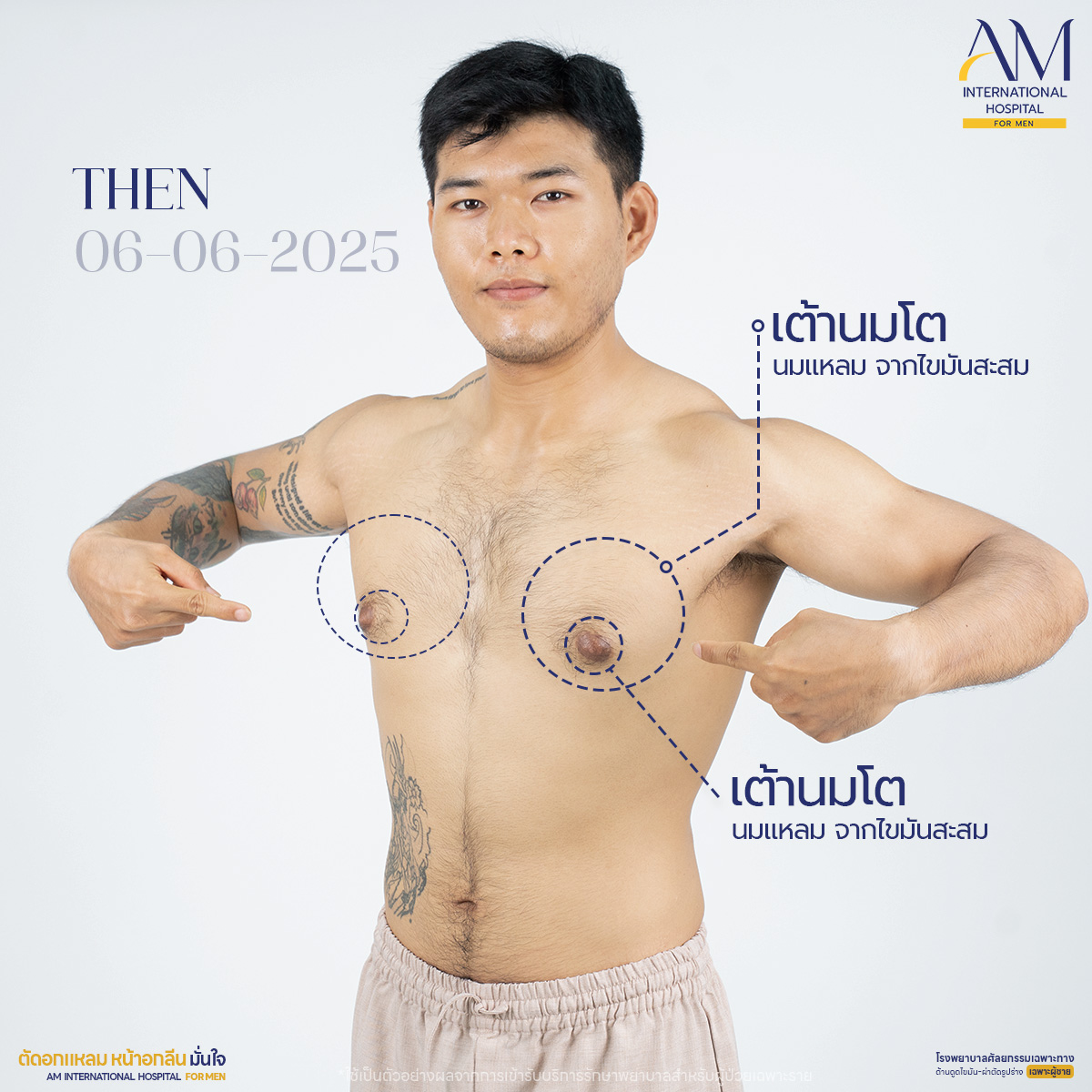 นมแหนม เต้านมโต คุณเบิร์ด
