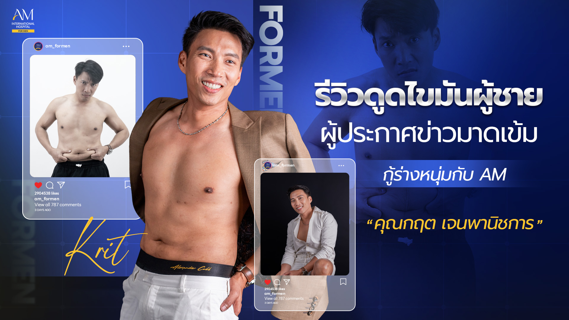 รีวิวดูดไขมันผู้ชาย