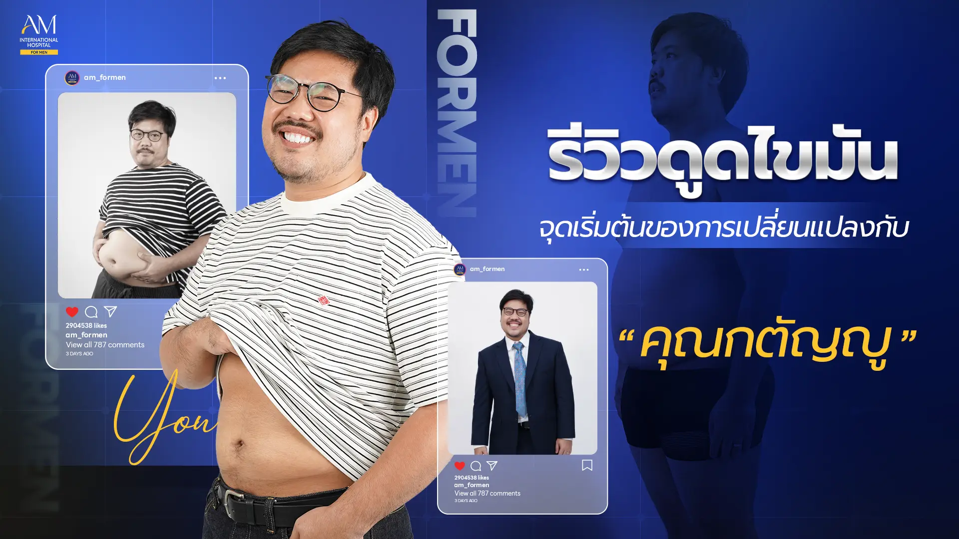 รีวิวดูดไขมัน กตัญญู