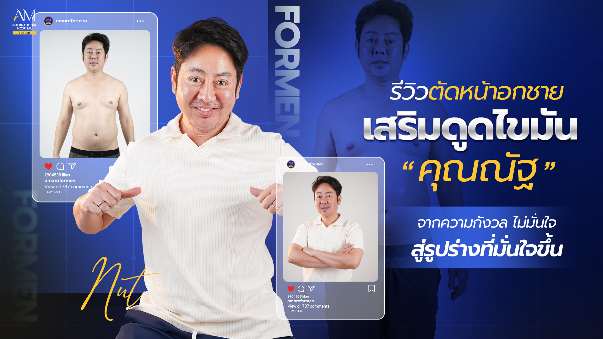 รีวิวตัดหน้าอก