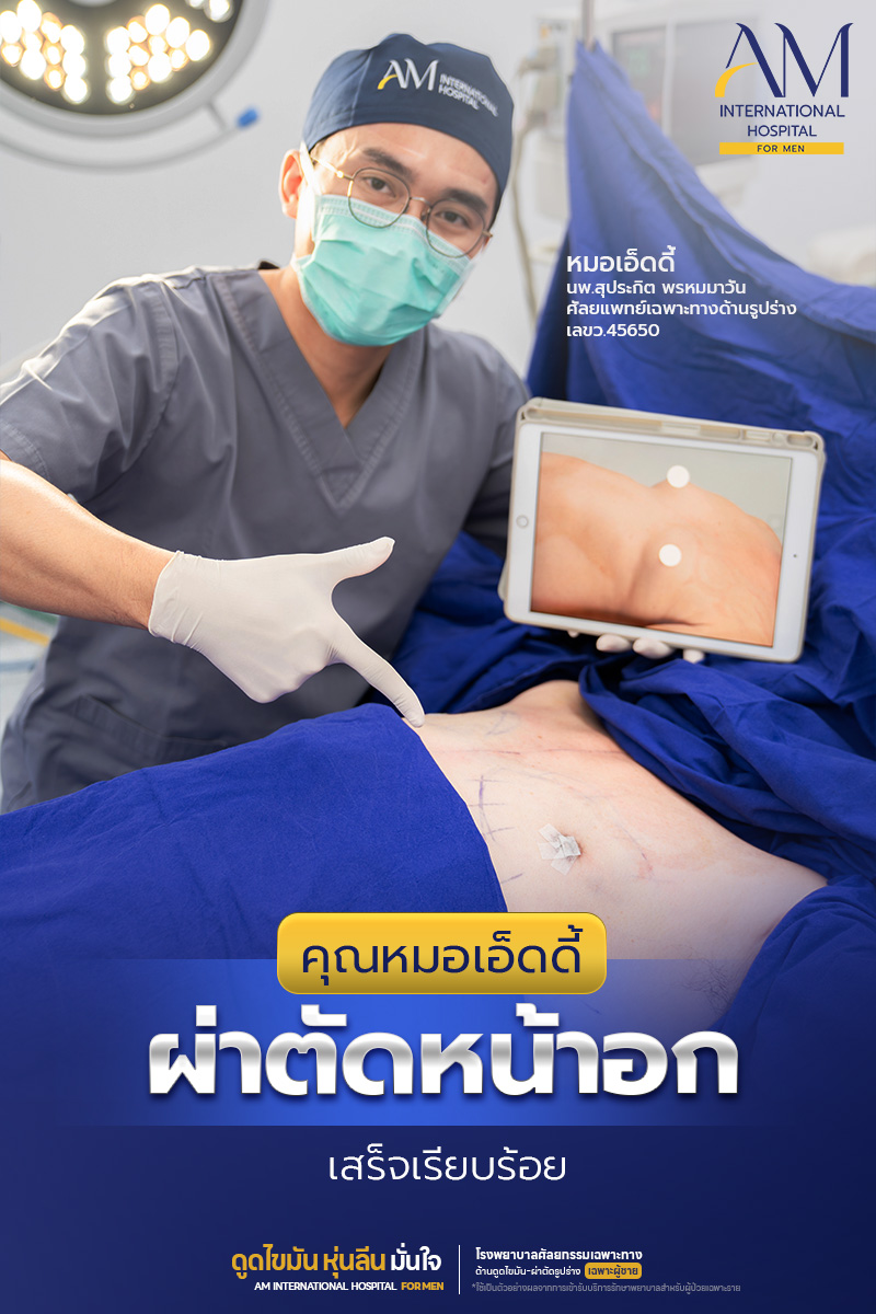 ผ่าตัดหน้าอกชายกับคุณหมอเอ็ดดี้ AM International Hospital