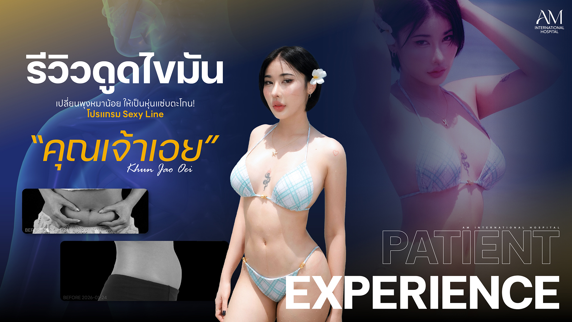 รีวิวดูดไขมัน