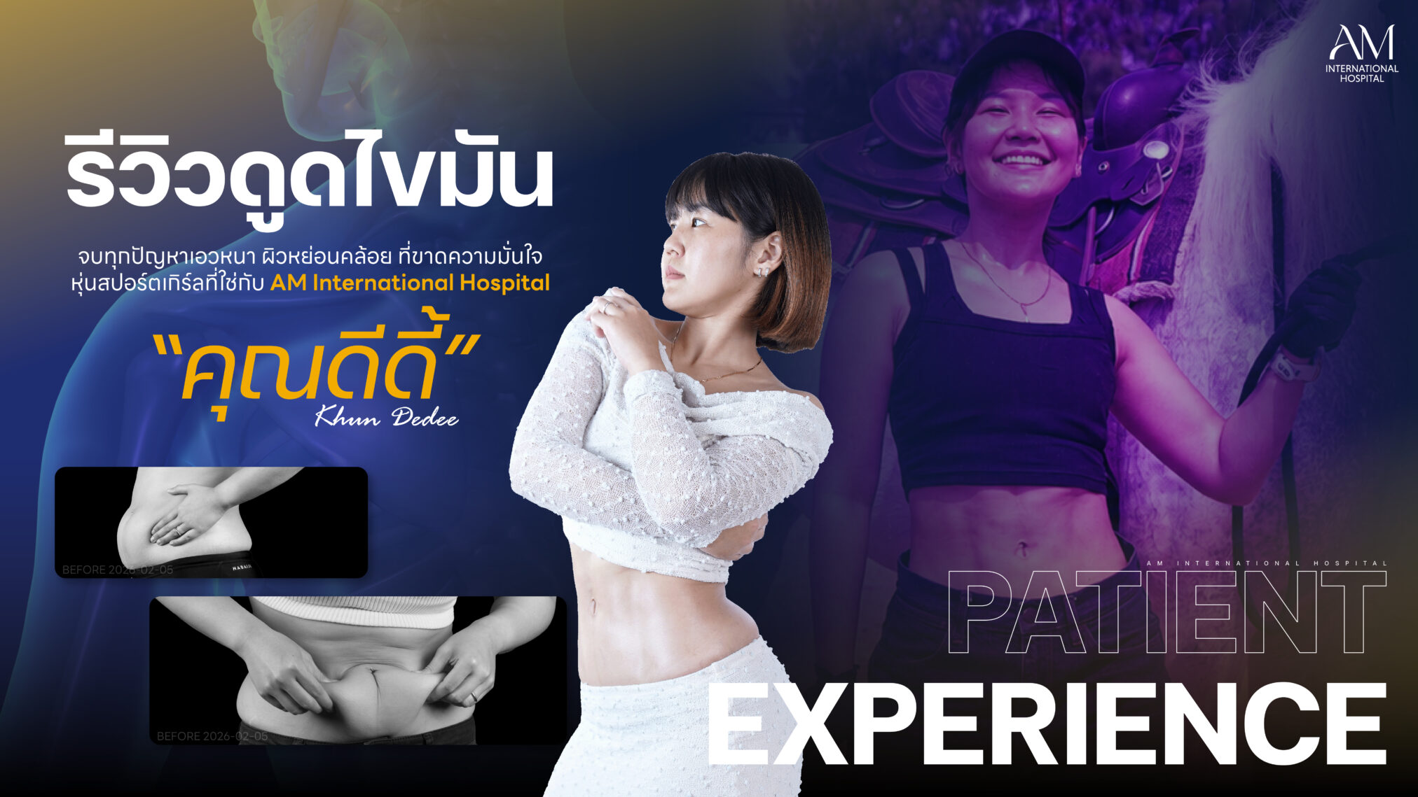 รีวิวดูดไขมัน