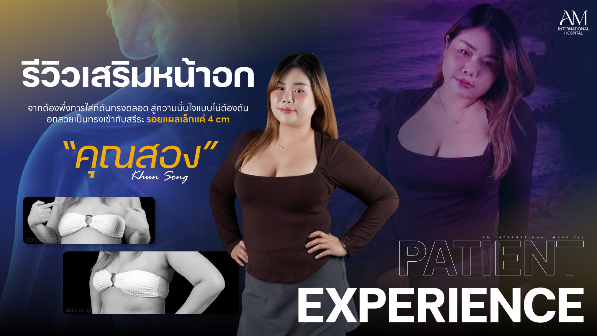 เสริมหน้าอก