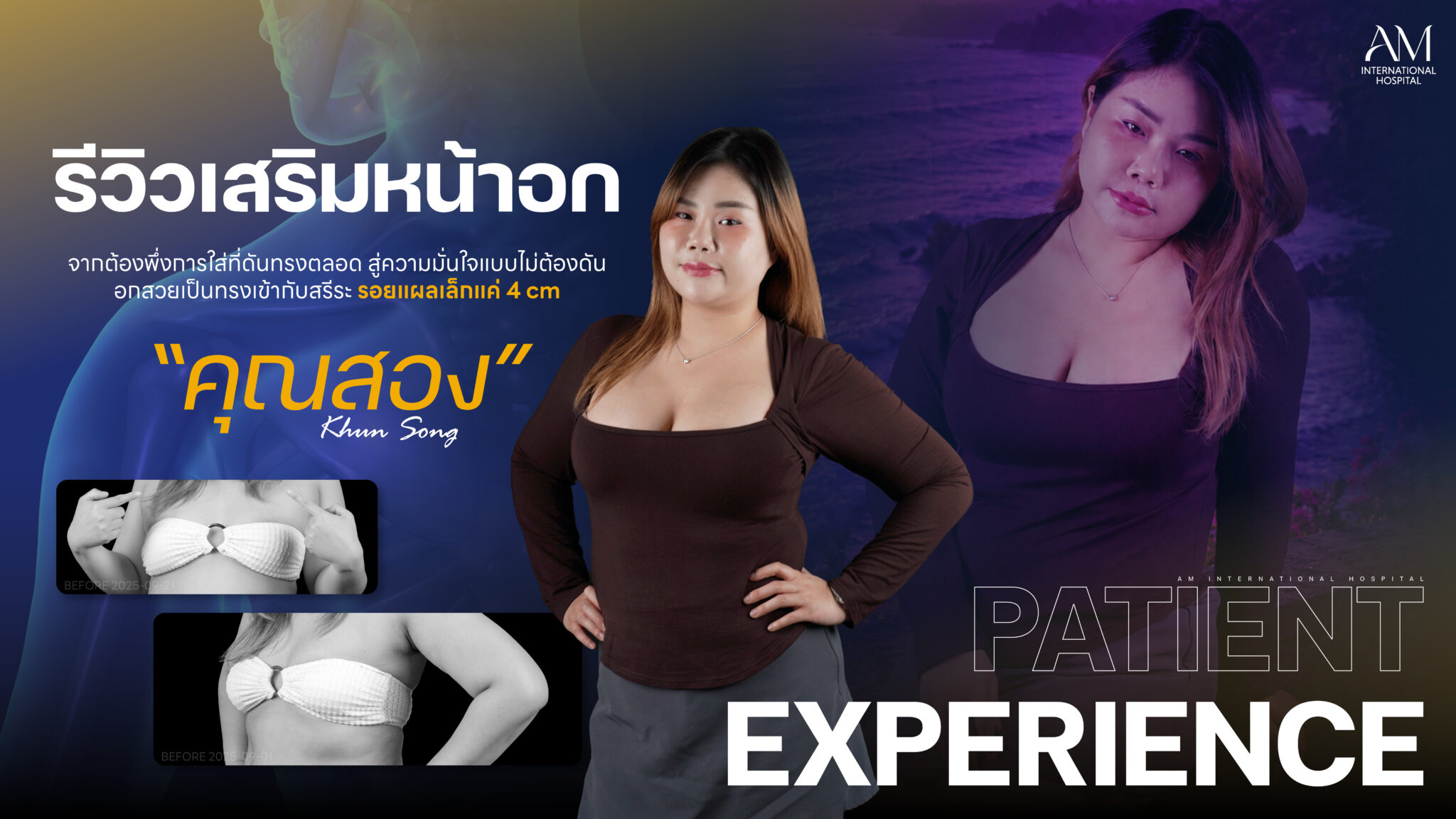 เสริมหน้าอก