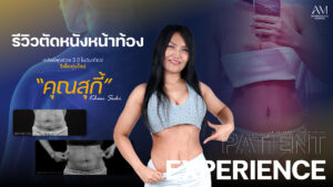 รีวิวตัดหนังหน้าท้อง