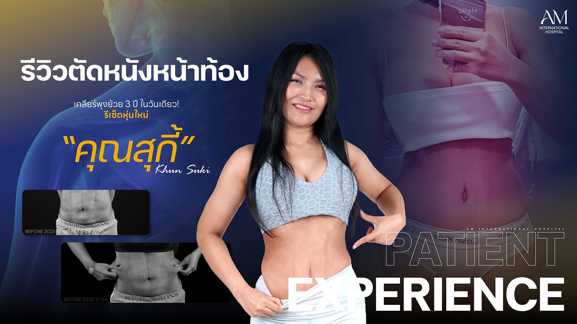 รีวิวตัดหนังหน้าท้อง