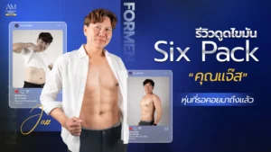 รีวิวดูดไขมันซิกแพค