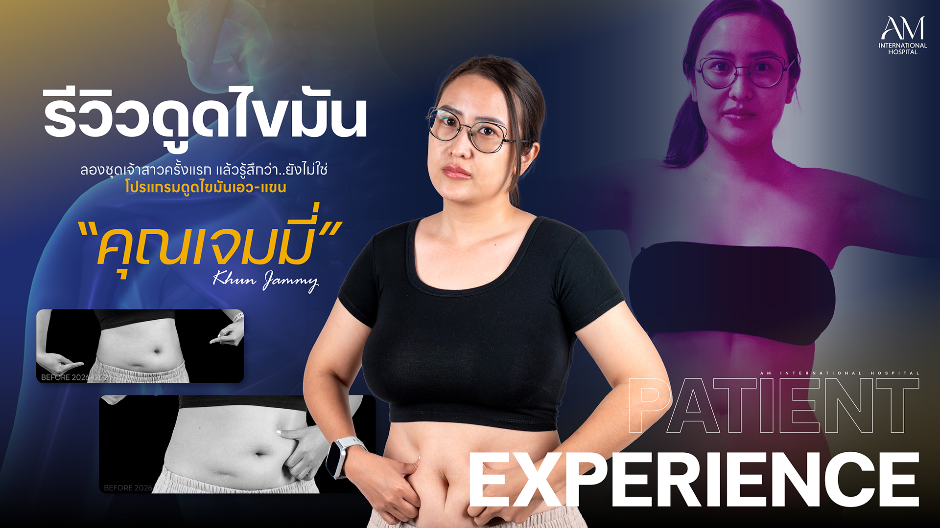 รีวิวดูดไขมัน