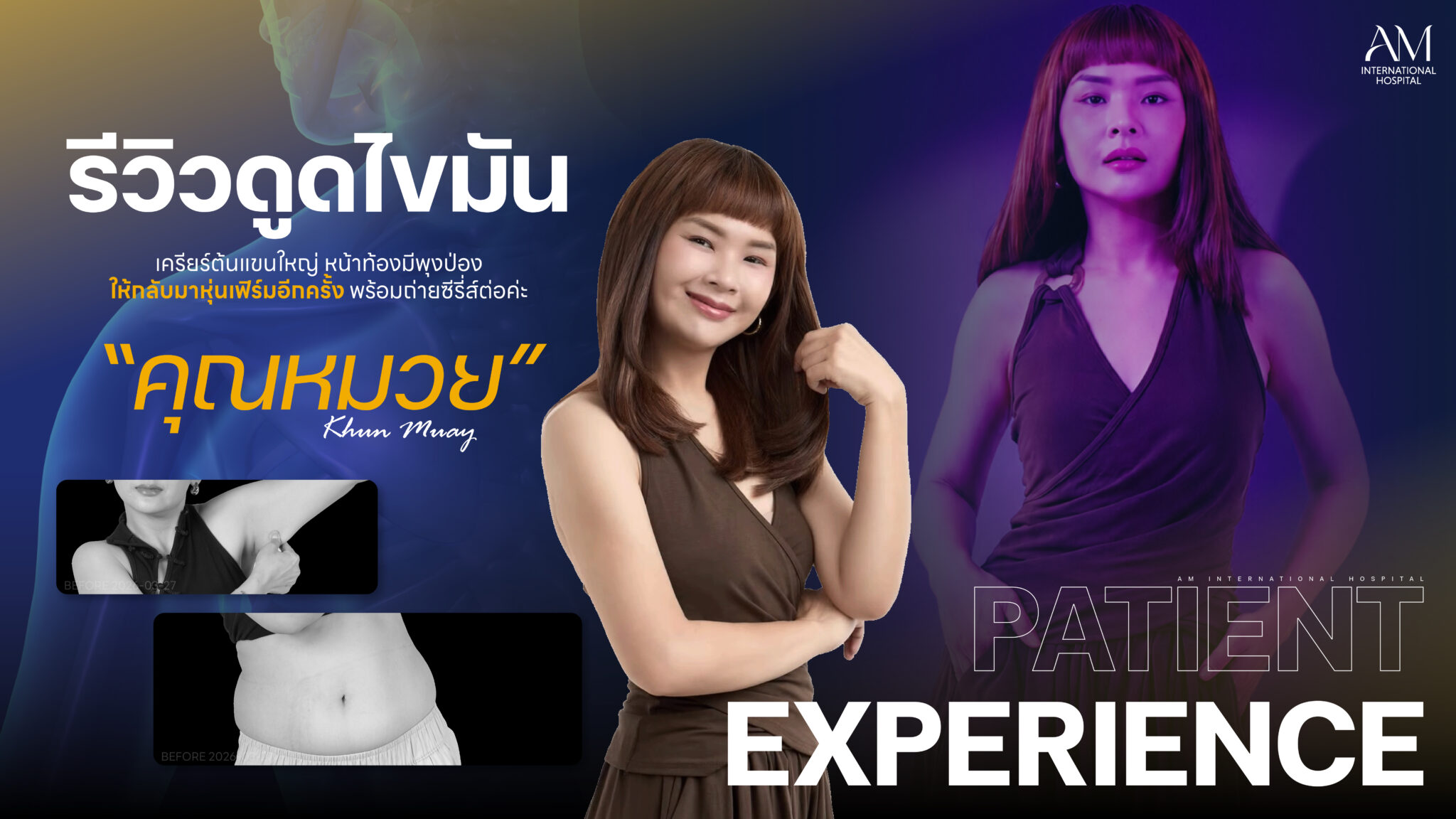 รีวิวดูดไขมัน