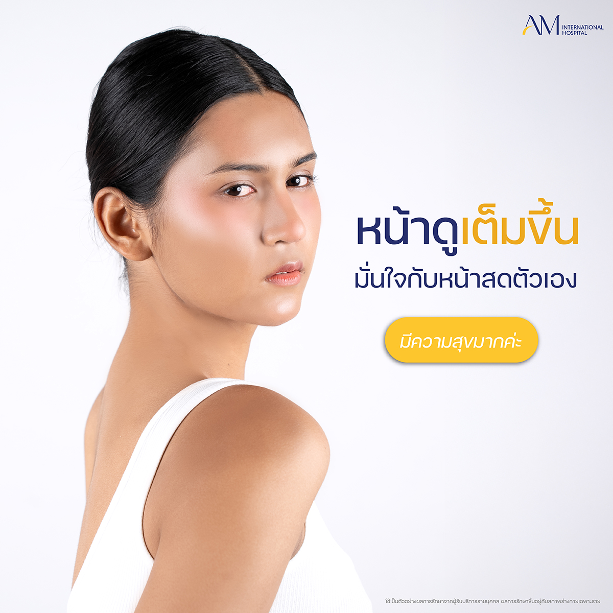 หลังฉีดโปรแกรมฟิลเลอร์ คุณลูกพลับ Surgery Wars